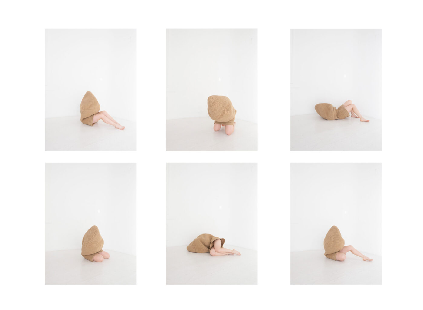 Прием оральных контрацептивов (КОК)&nbsp;— один из&nbsp;самых распространенных медикаментозных методов снижения симптомов и&nbsp;регуляции состояния при синдроме поликистоза яичников