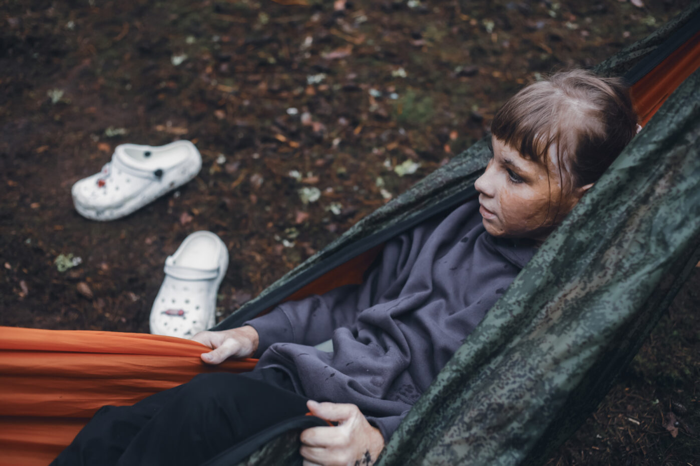 В&nbsp;Ярославской области работает единственный в&nbsp;России лагерь для детей с&nbsp;ожогами. Его организовал фонд «Детская больница» при больнице имени Сперанского