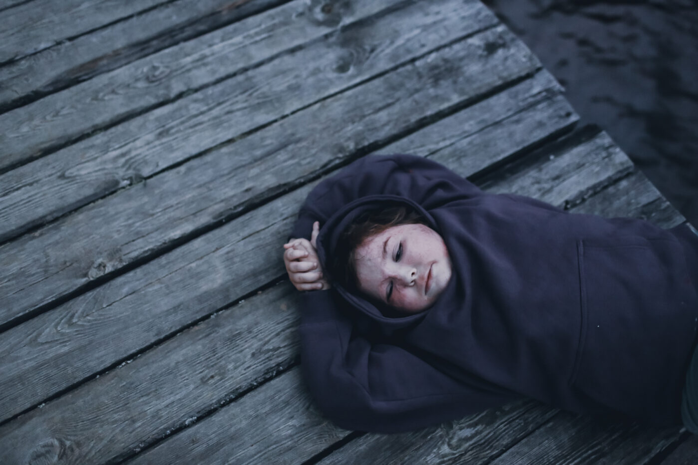 В&nbsp;Ярославской области работает единственный в&nbsp;России лагерь для детей с&nbsp;ожогами. Его организовал фонд «Детская больница» при больнице имени Сперанского