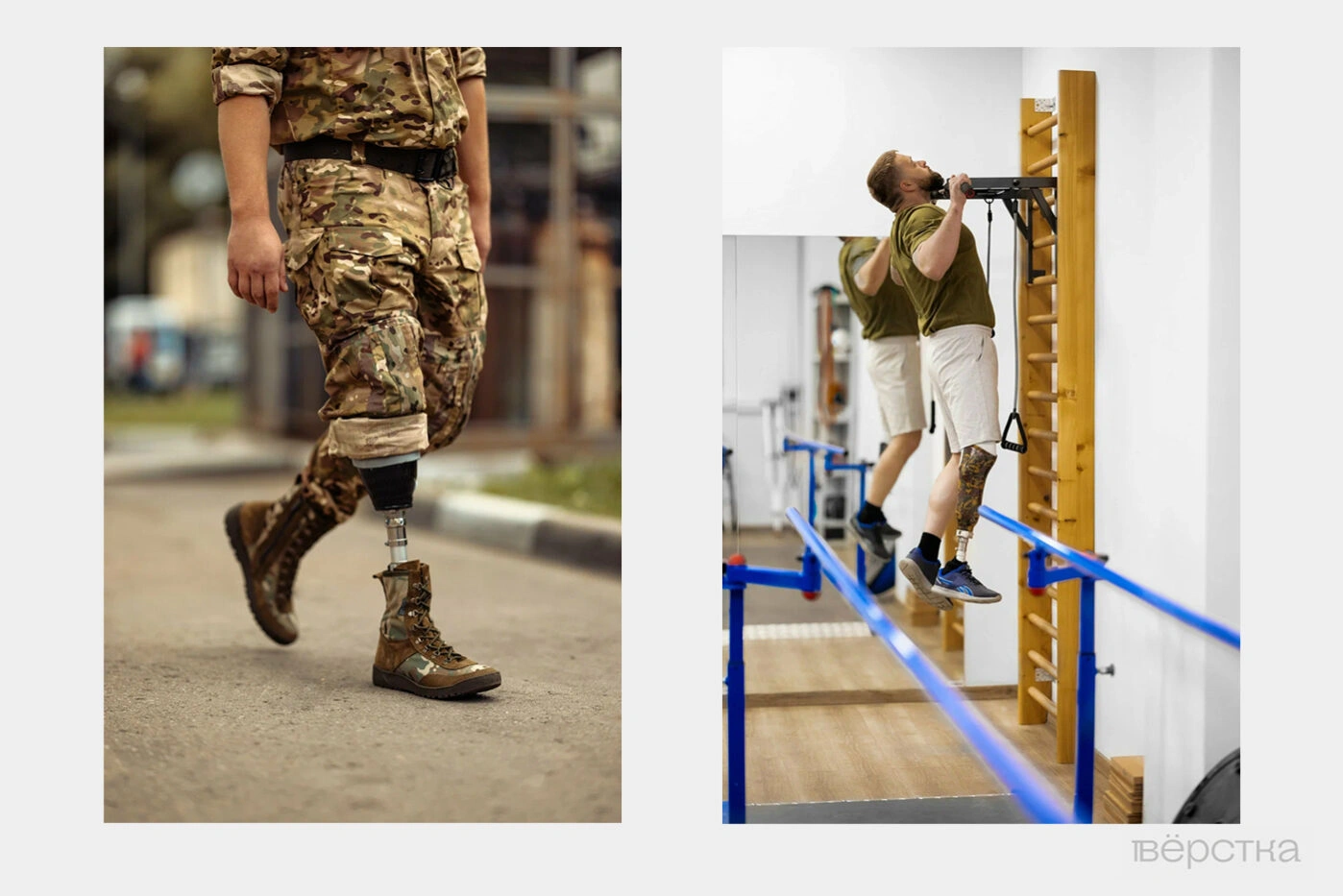 Протезы нижних конечностей могут быть гидравлические; пневматические и&nbsp;микропроцессорные&nbsp;— выбрать нужный помогут в&nbsp;специализированном реабилитационном центре